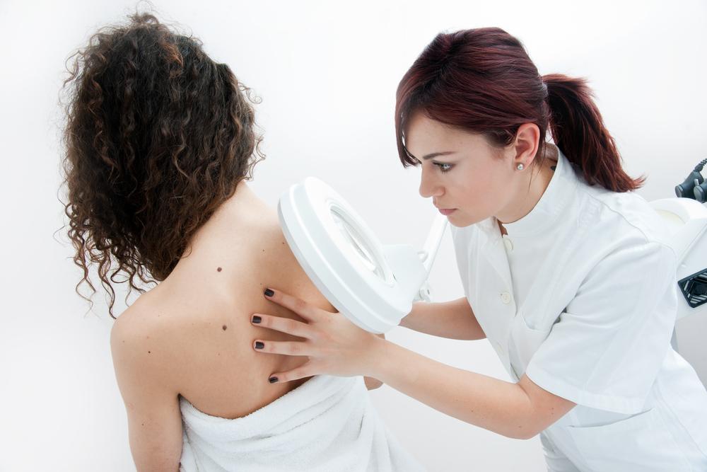 Role of Diet in the Prevention of Melanoma