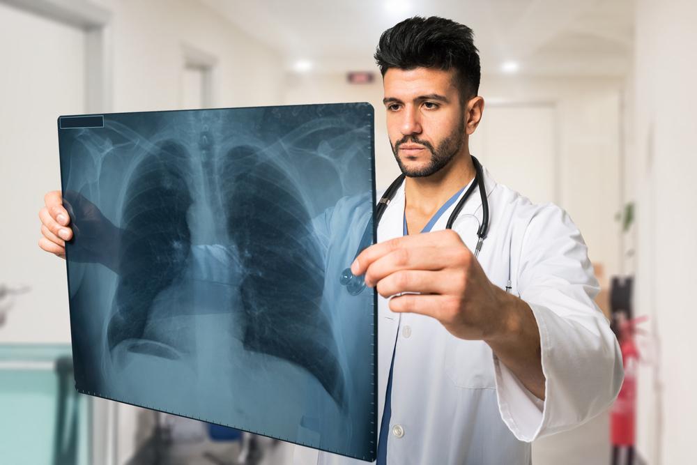 Treatments for Non-Small Cell Lung Cancer