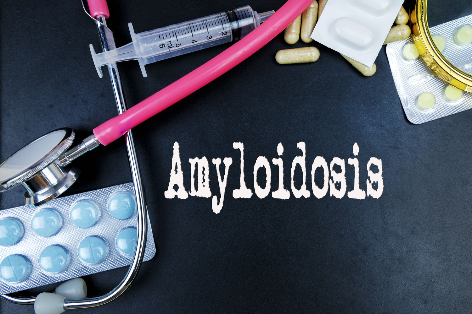 Diagnosis and Treatment for Different Types of Amyloidosis