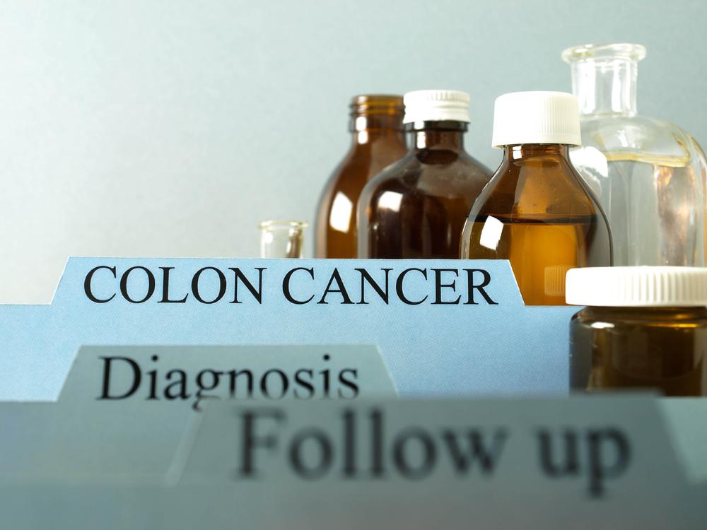 Modifying the Risk Factors of Colon Cancer