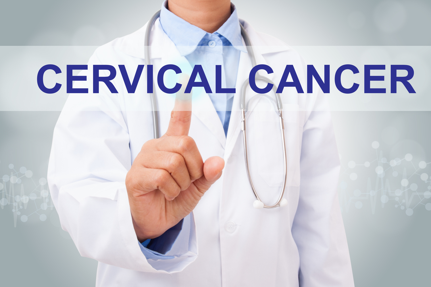 Managing the Side Effects of Cervical Cancer Treatments
